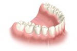 implant-multiple-implant5.jpg